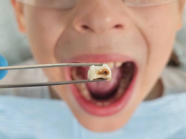 Best Pediatric Emergency Dentist in Attla, AL